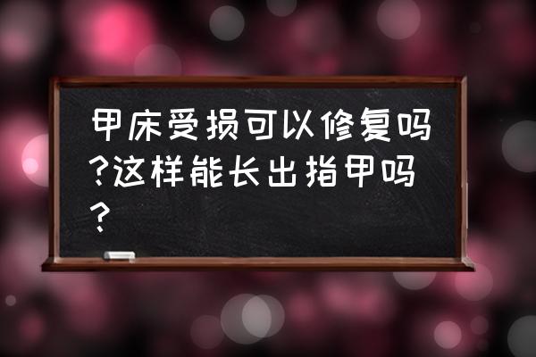 甲床能自己修复吗 甲床受损可以修复吗?这样能长出指甲吗？